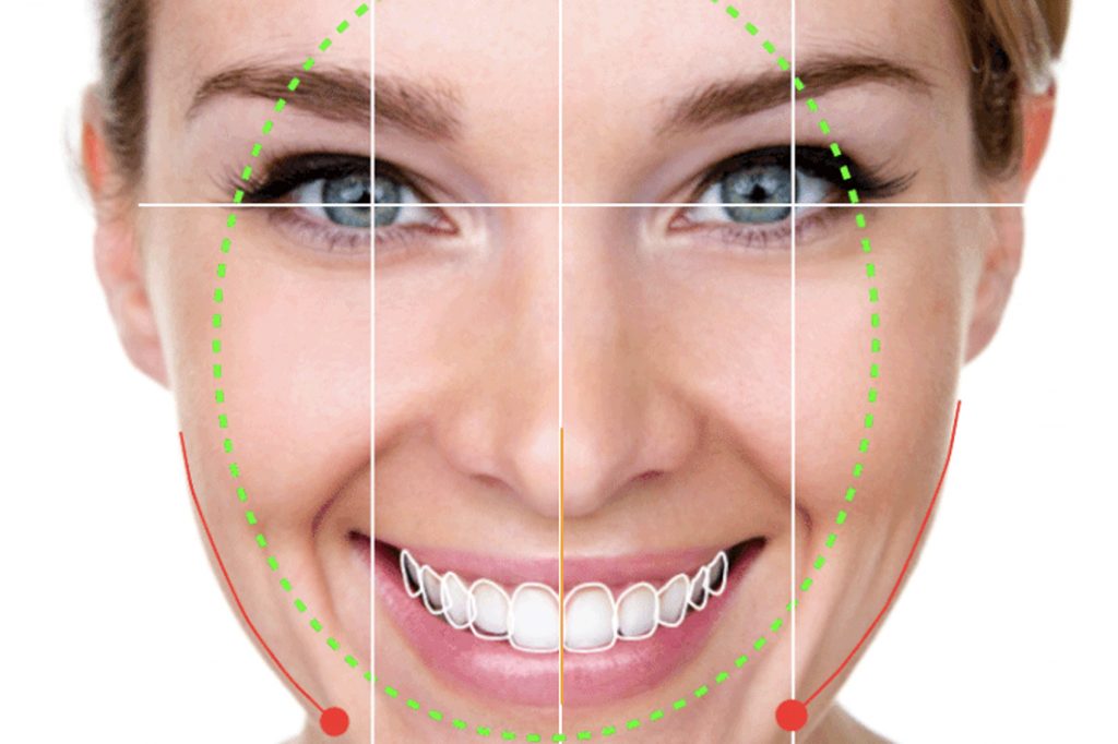 cómo se hace un diseño de sonrisa implantes dentales dentista
